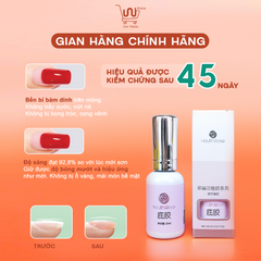 BASE - TOP - CỨNG MÓNG YOUNG ROSE CHÍNH HÃNG - 20ML